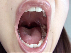 300人のおくち　3　サンプル画像06